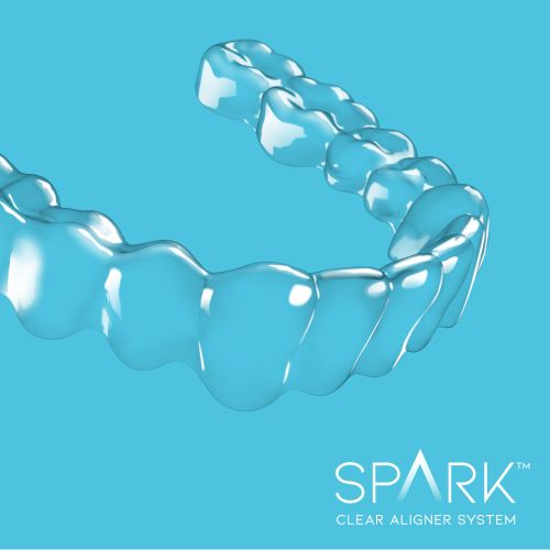 Spark Clear Aligners