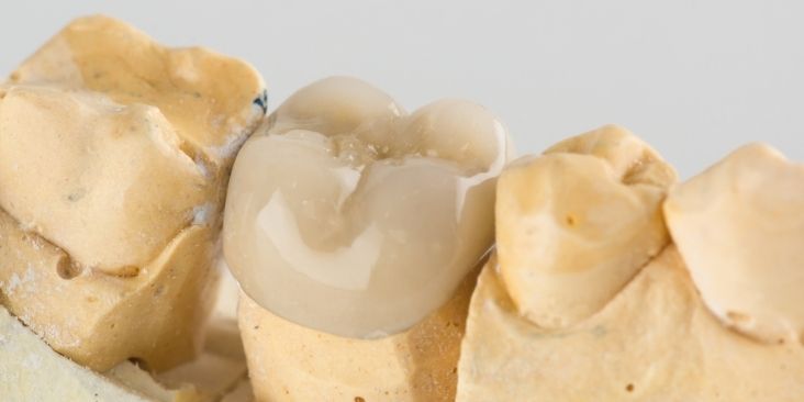 Dental crown