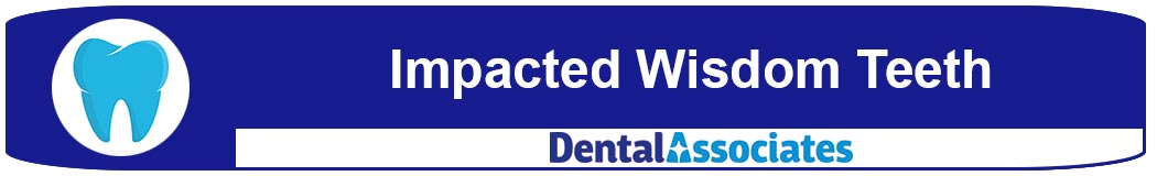 Impacted Wisdom Teeth