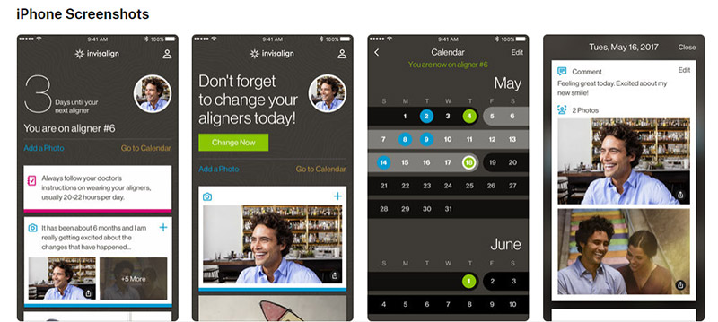 Invisalign smartphone app