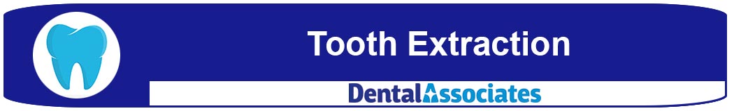 Tooth Extraction