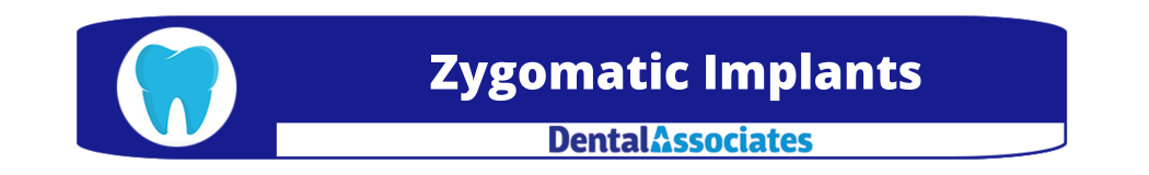 zygomatic implants